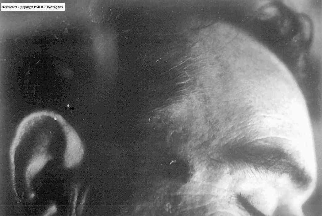Image result for Officer J. D. Tippit autopsy photos